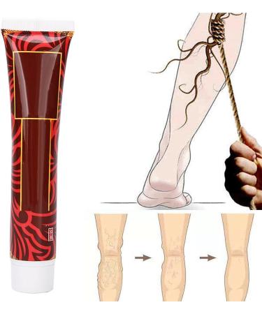 Varicose Vein Treatment Cream for Phlebitis & Angiitis | Blood Vessel Health Care - Buy Online on GoSupps.com