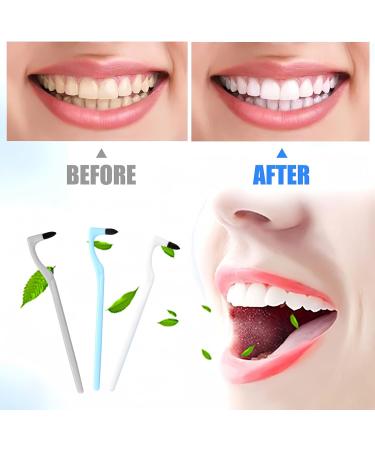 Quelcc 3-Piece Toothbrush Set | Stain & Tartar Remover | Soft Ricket Brush for Professional Tooth Cleaning | Remove Discoloration & Plaque - Buy Online on GoSupps.com