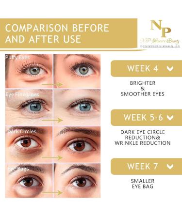 Anti-Wrinkle Eye Cream - Fast Absorbing Natural Ingredients for Dark Circles & Puffiness - 30g - Buy Online on GoSupps.com