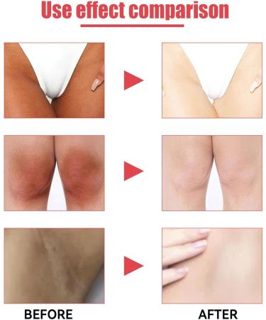 BEROZA 123pcs Skin Lightening Cream Underarm Brightening Skin Brightening Cream For Underarm Intimate Under Arm Even Skin Tint 1pc 1 piece - Buy Online on GoSupps.com