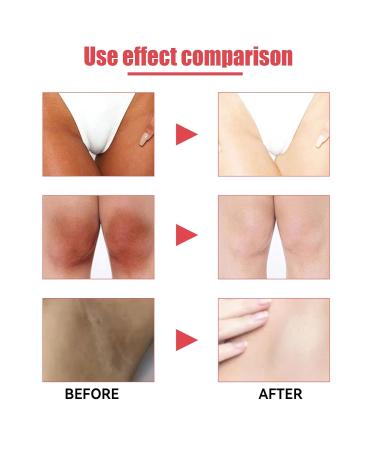 Crema Para Las Manchas De La Cara VVhitening Cream Crema para manchas oscuras en la cara Cremas Para Las Manchas De La Cara Oscuras Para Piel Entrepierna Manchas Codos Piernas Zonas Rodillas Cuello - Buy Online on GoSupps.com