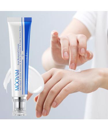 Scar Removal Cream - Rapid Repair for Acne, Surgery, Injury & Burns - 30g - Buy Online on GoSupps.com