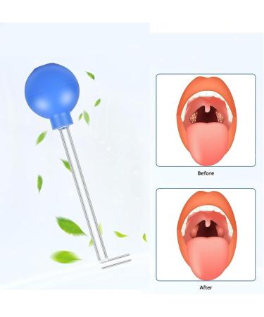 Vhger Tonsil Stone Remover Tool - Effective Almond Stones Cupping Glass for Fresh Breath & Oral Care - Buy Online on GoSupps.com