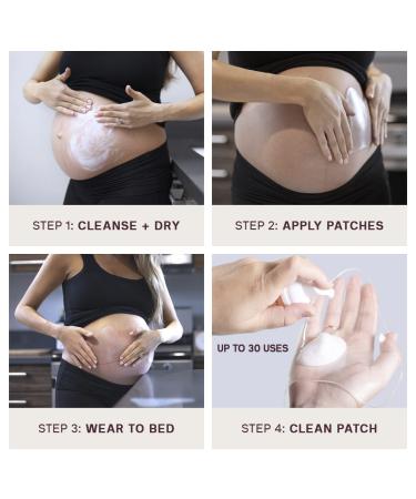 Buy Dermaclara Silicone Stretch Marks Patch Kit - Effective One Patch Solution for Scars | International Shipping Available - Buy Online on GoSupps.com