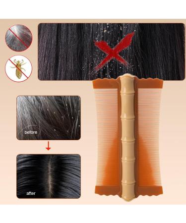 ASIEIT Lice Comb Flea Lice Removal Comb Double-sided Head Lice Comb Fine Tooth Scalp Massage Comb Bamboo Shape for Cats Dogs (Orange) - Buy Online on GoSupps.com