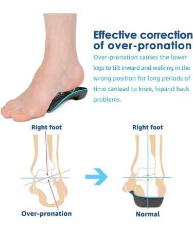 3/4 Plantar Fasciitis Insoles | High Arch Support Inserts for Foot Pain Relief | Metatarsal Support for Flat Feet | Medium Size for Men & Women - Buy Online on GoSupps.com