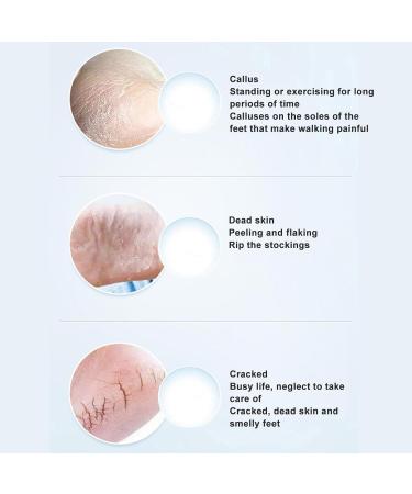 Electric Callus Remover Automatic Rechargeable Foot File with IPX6 Waterproof Design for Calluses and Corns - Buy Online on GoSupps.com