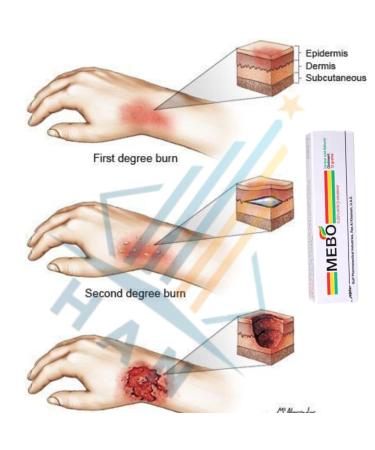 MEBO Burn Cream Ointment - 2 Tubes x 15g | Fast Healing First Aid for Wounds & Scars - Buy Online on GoSupps.com