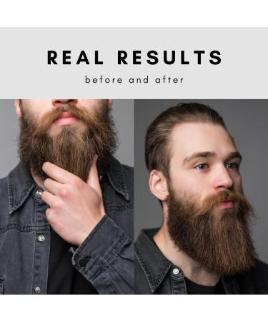 2023 Favorite Unscented Beard Oil | Thicken Growth & Soften Hairs | Relieve Itch & Flaking | Includes Beard Comb | 30ml - International Shipping Available - Buy Online on GoSupps.com
