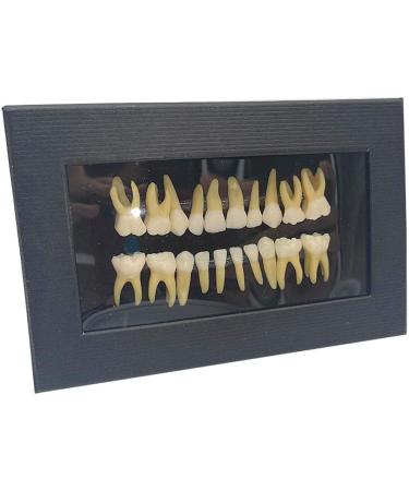 Fhuili Two-Color Permanent Teeth Model - 20 Artificial Dentures for Dental Study & Oral Demonstration - Buy Online on GoSupps.com