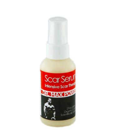 Dr. Max Powers Scar Serum for Face and Body Removes New and Old Scars Surgery Stretch Marks 2oz