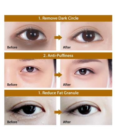 Collagen Eye Masks (30 Pairs) - Anti-Aging Pads for Wrinkles Dark Circles & Puffiness - Black Pearl Eye Pads - Buy Online on GoSupps.com