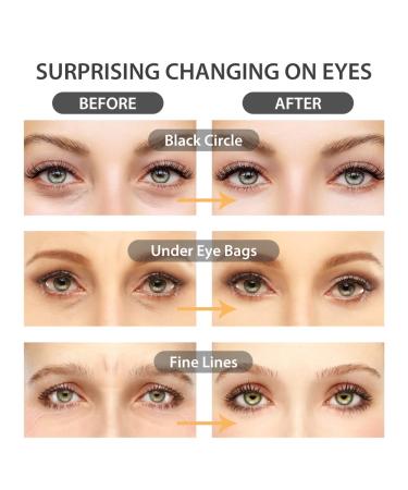 Newgo Eye Pads - 20 Pairs of Hyaluronic Acid Collagen Gel Pads for Dark Circles Puffiness & Anti-Fold Care - Buy Online on GoSupps.com