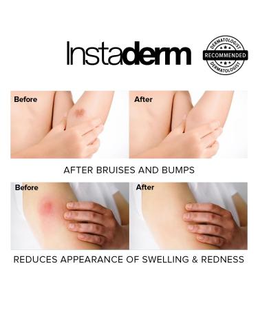 Yuicy Biotin Hair Gummy Bears - Sugar-Free 180 pcs | High-Dose 10mg Biotin for Hair Growth Skin & Nails - Delicious 3-Pack - Buy Online on GoSupps.com