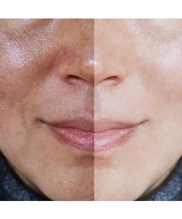 Shop 2-in-1 Facial Brightener Kit | Boost Radiance & Glow - International Shipping Available - Buy Online on GoSupps.com