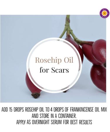  Deve Herbes Deve Herbs Pure Rosehip Seed Oil (Rosa rubiginosa) Natural Therapeutic Grade Cold Pressed 100 ml - Buy Online on GoSupps.com