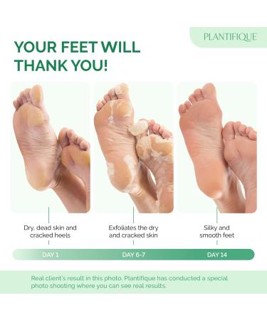 Plantifique Foot Peeling Mask - Combo 4 Pack for Soft & Smooth Feet - Buy Online on GoSupps.com