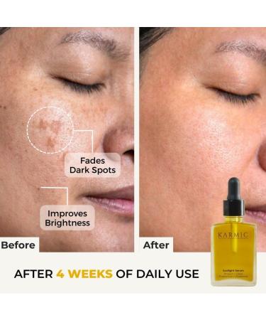 Karmic Skin Brightening Vitamin C Face Serum: With Saffron & Vit. E | Hydrate & Reveal Bright Glowing Skin | Correct Dark Spots | Treat Hyperpigmentation | Organic Facial Oil Skin Care | Women & Men - Buy Online on GoSupps.com