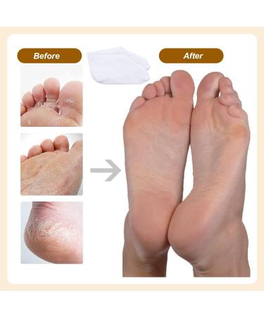 Scettar 4 Pairs Moisturizing Overnight Spa Socks for Dry Feet - Cotton Moisture Enhancing, Thin Foot Spa Socks for Cracked Heels - Buy Online on GoSupps.com