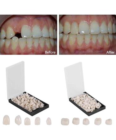 Tooloflife Temporary Tooth Crown - 70 Parts Box Realistic Provisional Dental Care for Front & Back Teeth (140 Pieces) | International Shipping Available - Buy Online on GoSupps.com