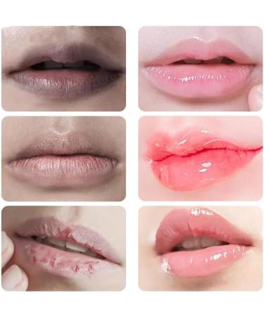 Korean Lip Serum Dark Lip Serum Moisturizing and Nourishing Lip Serum Lips Pink Fresh Treatment Balm for Dry Lips Lighten Lip Wrinkles - Buy Online on GoSupps.com