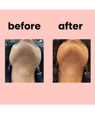 Liora Beauty Cream Liora Beauty Hair Removal Cream Liorabeauty Facial Cream Liora Beauty Facial Hair Removal Cream Liorabeauty Facial Hair Removal Liorabeauty Hair Removal Kit - Buy Online on GoSupps.com