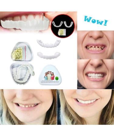 Flipped Warm Dentures - 2 Pairs of Plug-In False Teeth | Cosmetic Temporary Artificial Teeth - Buy Online on GoSupps.com