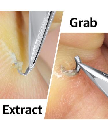 Durox Splinter Remover Tweezers - First Aid Tool for Splinter Removal and Camping Emergencies - Buy Online on GoSupps.com