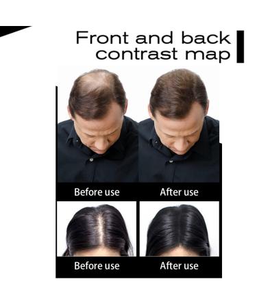 Gowwim Hair Thickening Fibers 3-in-1 Kit Set - Keratin Hair Building Fibers with Atomizador Pump Nozzle & Lock Hold Spray for Instantly Covering Sparse Hair Areas (Black) - Buy Online on GoSupps.com