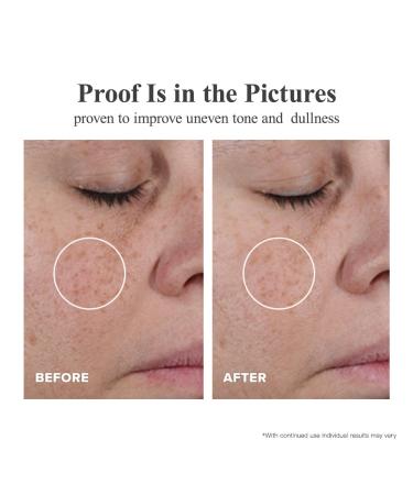 Triple Retinol &Triple Vitamin C Serum for Face - Anti-Aging Wrinkle Night Retinol +HPR Capsules Peptide Serum for Women Reduce Fine Lines Tighten Sagging Skin Vitamin A - Buy Online on GoSupps.com