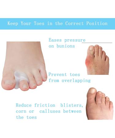 MENOCADY 12-Pack Gel Toe Separator for Bunions - 1/4 Thick Big Toe Spacers - Single Loop Toe Spreader for Overlapping Toe Correction (Clear) - Buy Online on GoSupps.com