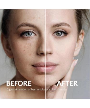 Rivocoda Hydraquinonol Dark Spot Brightening Cream - 4% Bleaching Cream Non-Irritating Hydrating For All Skin Types 1oz - Buy Online on GoSupps.com