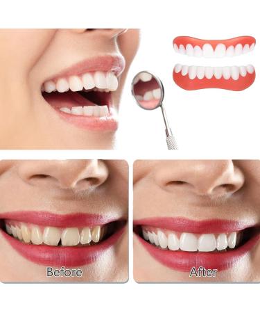 Buy False Teeth Veneers | Cosmetic Tooth Covers & Provisional Dentures - International Shipping - Buy Online on GoSupps.com