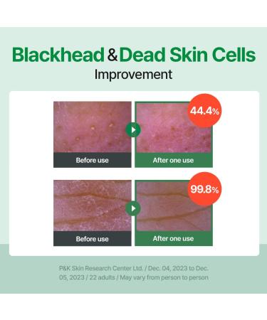 MAKE P:REM INTECA Trouble Soothing Pads Dual-Texture Jumbo Pad for Exfoliating Blackheads and Sebum Care for Sensitive Skin Korean Skin Care 11.15 Fl Oz 330ml (70 Pads) - Buy Online on GoSupps.com