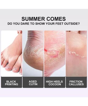 5 Pair Foot Mask - Intensive Peeling & Moisturizing Socks for Dry & Cracked Feet | Foot Spa Treatment for Men & Women - Buy Online on GoSupps.com