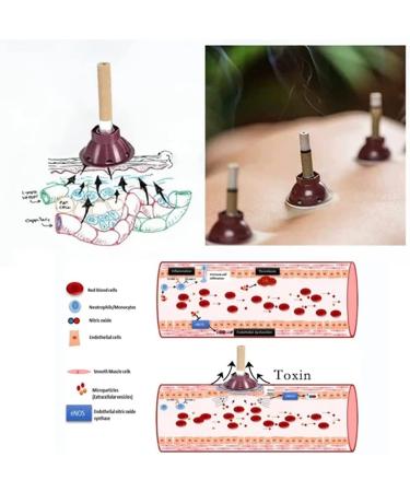 Moxibustion Gathering Energy & Detoxification Slimming Sticks - 20PCs Moxa Sticks for Effective Slimming and Wellness - Buy Online on GoSupps.com