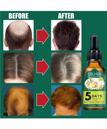dijiusidy Ginger Hair Growth Oil Prevent Baldness Good-absorption Fast Growing 30MLSerum Nourish Tools Female - Buy Online on GoSupps.com
