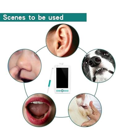 HeiDD Ear Wax Removal Tool Digital Otoscope with 4.3 Inches Screen Ear Camera with 6 LED Lights 5.5mm Visual Ear Cleaning Camera IP67 Waterproof - Buy Online on GoSupps.com