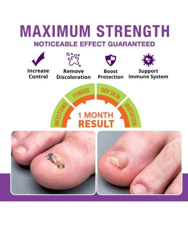 PURE GROWN BY NATURE Pureskin Nail Repair - 1.7 Oz. - Buy Online on GoSupps.com