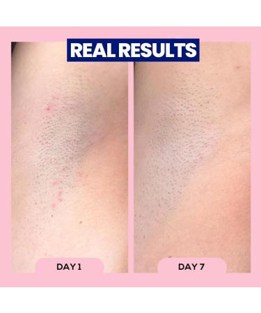 Discover megababe AprÃ¨s Shave - Ingrown Hair & Razor Bump Roll-On 3 oz - Elevate Your Style Instantly! - Buy Online on GoSupps.com