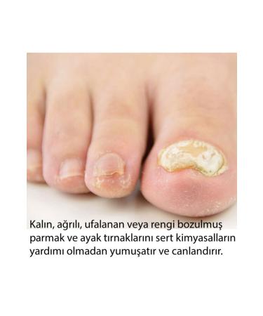 Cabs Nail Care and Foot Cream - Nail Fungus Prevention Lotion Drops - Buy Online on GoSupps.com