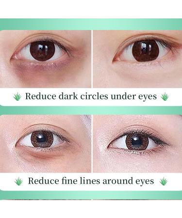  Pemarlis Aloe Vera Skincare Eye Serum with Aloe Vera Moisturizing Eye Cream Eye Pads Aloe Vera Eye Mask Aloe Eye Serum 2 Pack - Buy Online on GoSupps.com