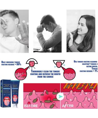 Miioto Tongue Cleaner & Scraper Set | 50g Tongue Cleaning Gel + Brush | Freshens Breath & Eliminates Bad Breath | International Shipping - Buy Online on GoSupps.com