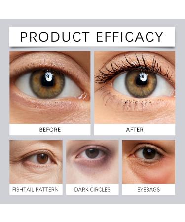  Yoelau Retinol eye cream for dark circles and puffiness - Anti-aging moisturizing eye cream that reduces fine lines wrinkles and under-eye bags - Firming serum and - Buy Online on GoSupps.com