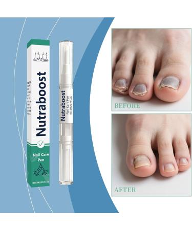 Nail care pen 3 ml repair solution for toenails natural and strengthening for yellowing and thickening of the skin older men feet home - Buy Online on GoSupps.com