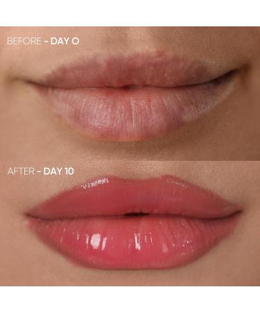 Red Light Therapy Lip Plumper Device | Enhance Lips & Reduce Fine Lines | LED Lip Plumping Tool for Anti-Aging - Buy Online on GoSupps.com