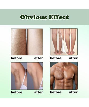 Hair Removal Spray Intimate Painless Hair Remover for Sensitive Skin Depilatory Cream for Legs Arms Underarms and Private Areas Non-Irritating Painless Flawless - Buy Online on GoSupps.com