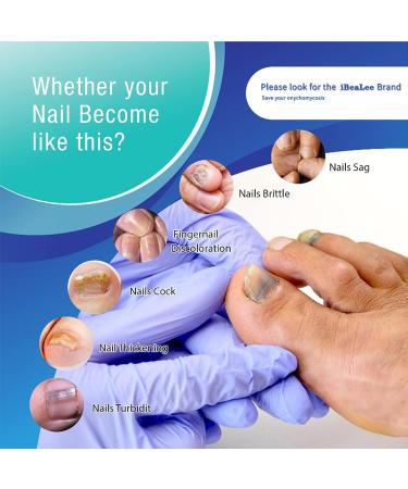 Nail Fungal Treatment Spray - Advanced Toenail & Nail Strengthener Repair - 10ml - Buy Online on GoSupps.com