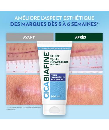 Cicabiafine | Soothing Multi-Repairing Balm (100 ml tube) Repair Balm for Damaged Scar Skin Soothing Balm to Improve the Appearance of Scars - Buy Online on GoSupps.com