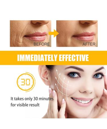 Smile Line Patches - 10pcs Collagen Hydrating Masks for Anti-Aging Smoothing Laugh Lines & Wrinkles - Buy Online on GoSupps.com